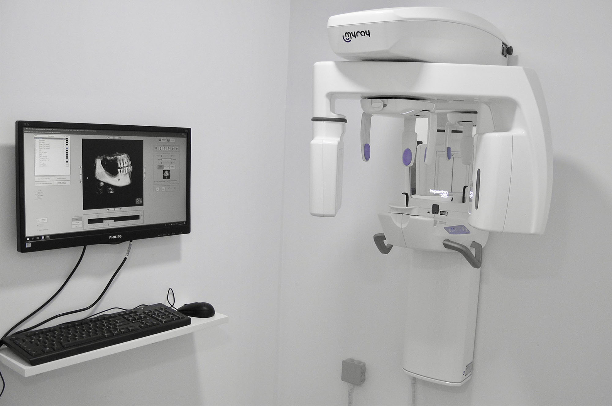 Imagen general MyRay sistema radiográfico en clínica dental Navarro